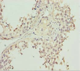 Polyclonal Rabbit anti-Human REEP1 Antibody (IHC, WB)