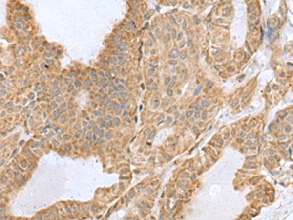 CSRP2 Antibody