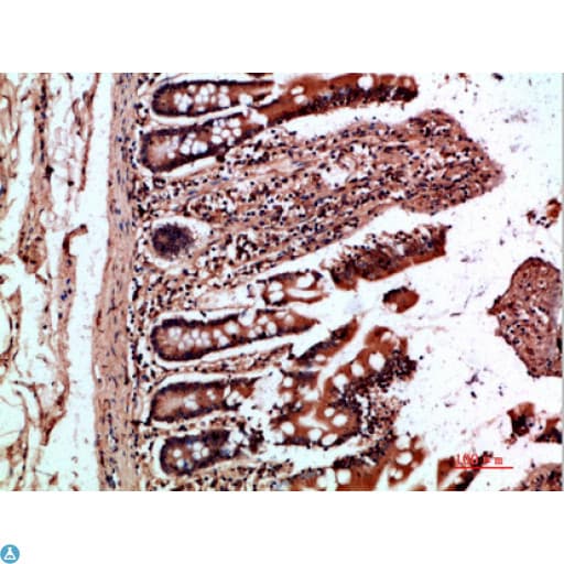 OSM / Oncostatin M Antibody