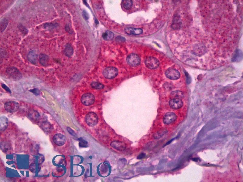 IHC-plus™ Monoclonal Mouse anti-Human MAPK8 / JNK1 Antibody (clone 3B12, IHC, WB)