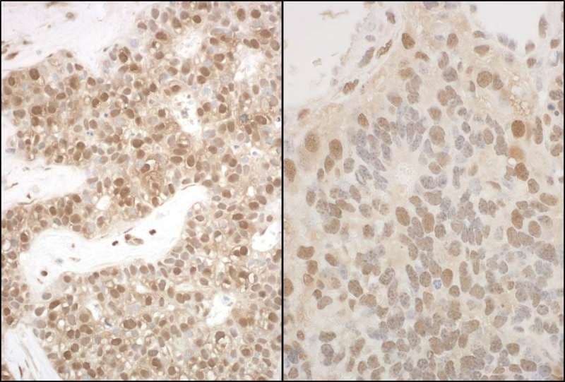 PSMA5 Antibody (aa100-150)