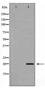 BBC3 / PUMA Antibody