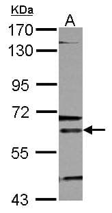 ALAS2 Antibody (aa211-587)