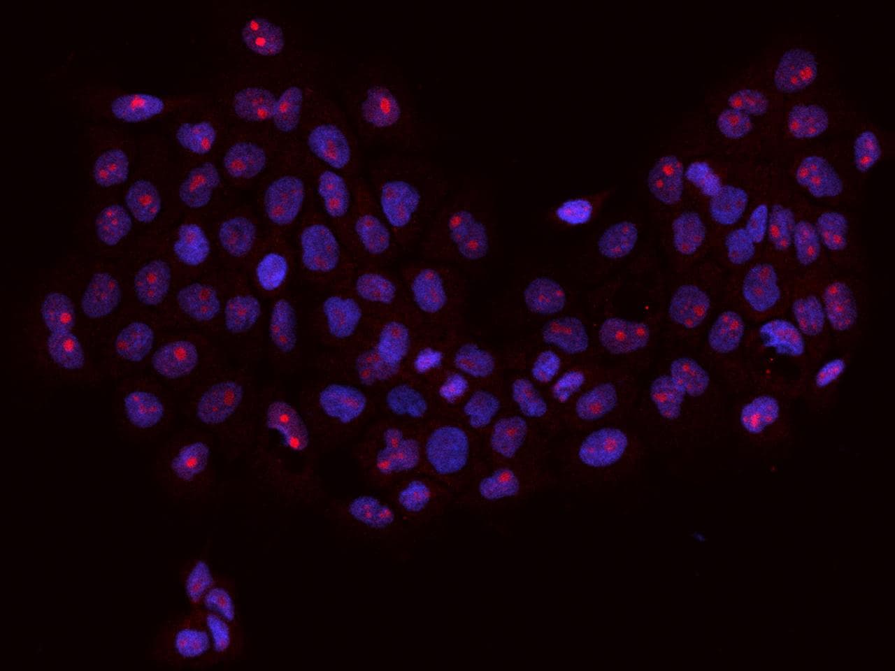 RBM34 Antibody