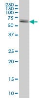 IHC-plus™ CBS Antibody (clone 3E1)