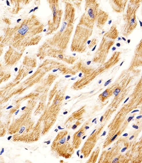 SMAD1 Antibody (aa163-196)