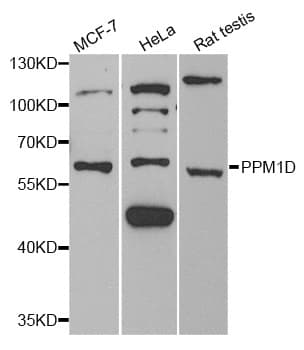 Polyclonal Rabbit anti-Human PPM1D / WIP1 Antibody (WB)