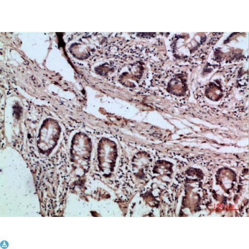 VIL1 / Villin Antibody