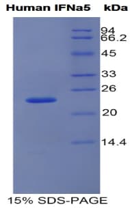 Human IFNA5 / Interferon Alpha 5 Protein (Recombinant His)
