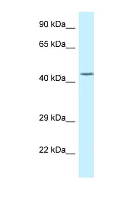 DUSP9 Antibody (aa148-197)