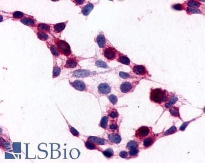 PathPlus™ ADGRE5 / CD97 Antibody (N-Terminus)