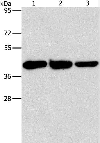 Aspartate Aminotransferase Antibody