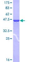 Human COMMD1 Protein (Recombinant GST)