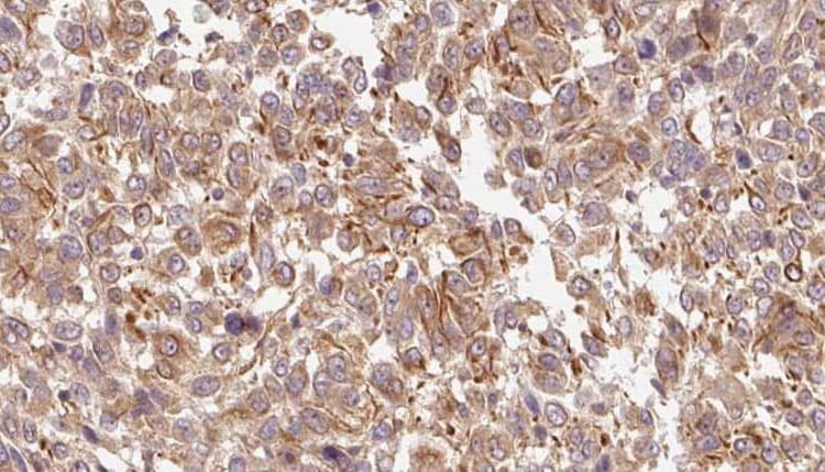 INHBC Antibody
