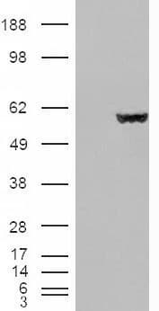 IHC-plus™ FH / Fumarase / MCL Antibody (aa176-189)