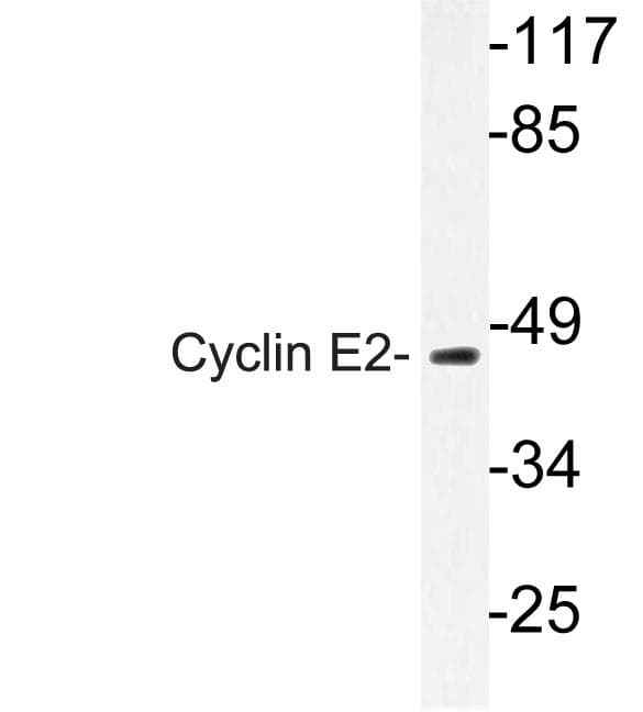 CCNE2 / Cyclin E2 Antibody (Asn387)