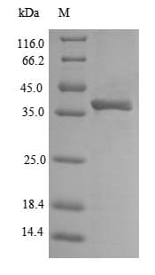 Escherichia coli ompA Protein (Recombinant 6His-SUMO, N-terminus)