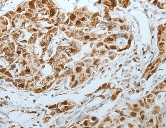 MCM3 Antibody