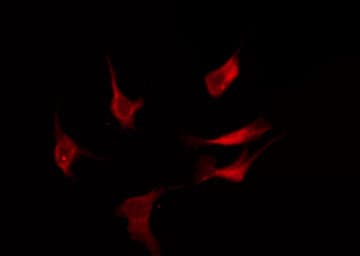 Polyclonal Rabbit anti-Human OR52D1 Antibody (IF, WB)