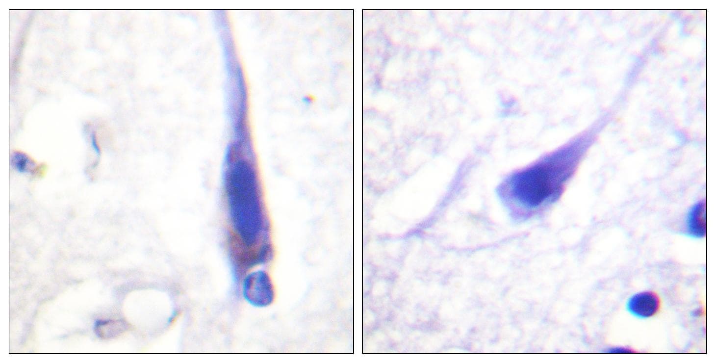 CALM1 / Calmodulin Antibody (p79/81)