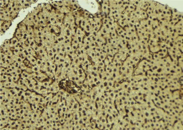 Polyclonal Rabbit anti-Human NF90 / ILF3 Antibody (IHC, WB)
