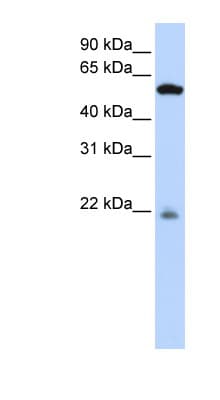 PM20D2 / ACY1L2 Antibody (aa252-301)