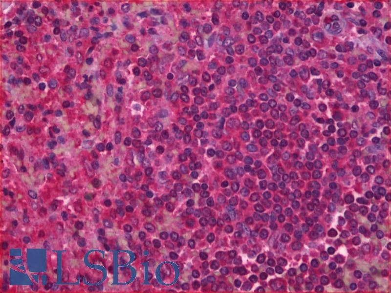 IHC-plus™ Polyclonal Rabbit anti-Human Leukotriene B4 Receptor / BLT1 Antibody (aa331-352, IHC, WB)