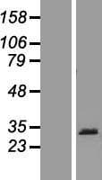 Human PRB1 Protein (Over-Expression Lysate Myc-DDK (Flag))