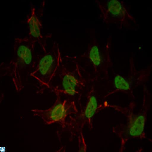 ER Alpha / Estrogen Receptor Antibody