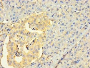 Polyclonal Rabbit anti-Human CDC25C Antibody