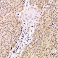SBDS Antibody