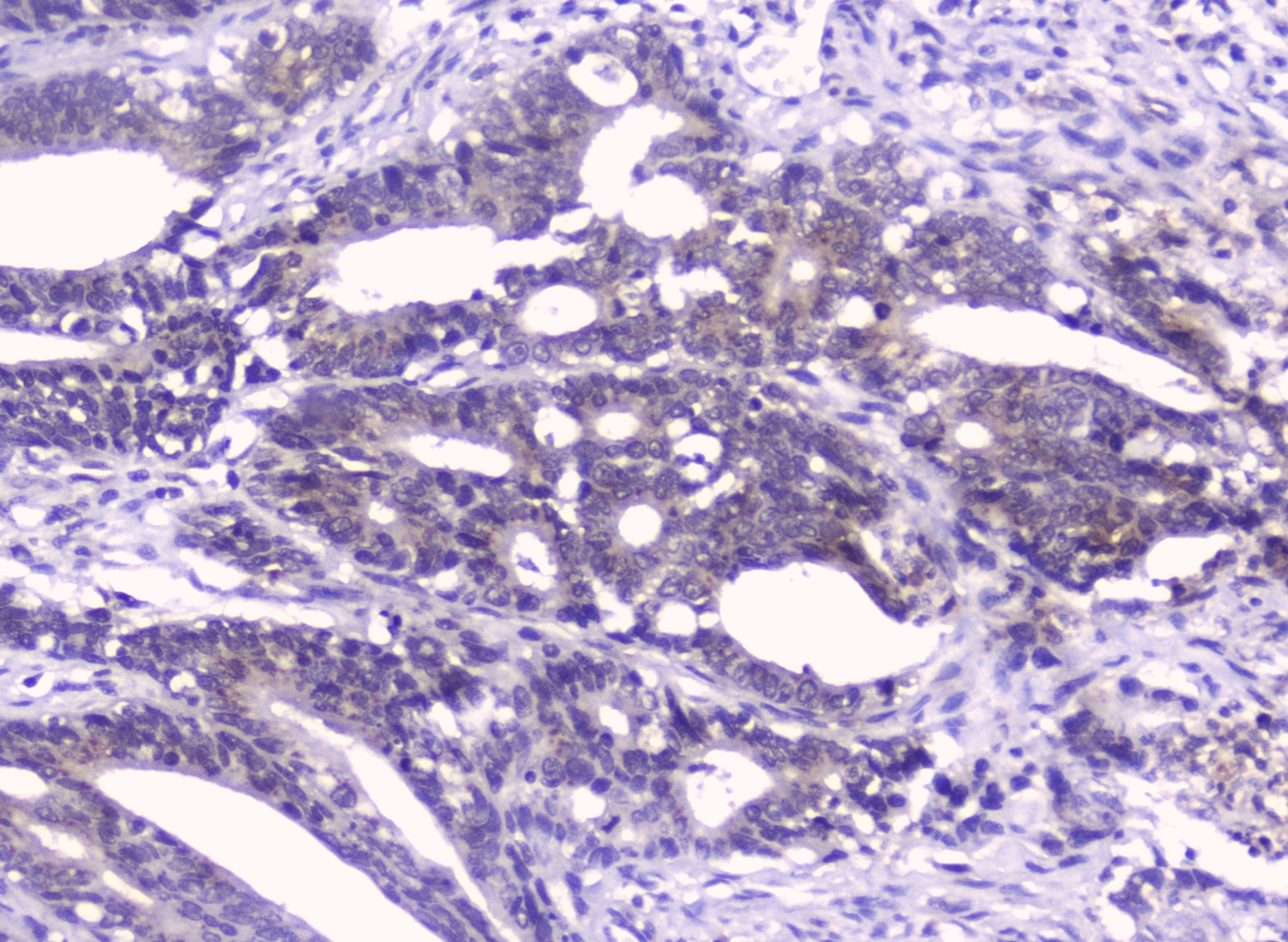 Polyclonal Rabbit anti-Human GOLPH3 Antibody (IHC, WB)