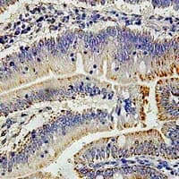 ACS5 / ACSL5 Antibody