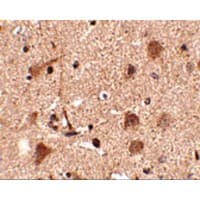 Polyclonal Rabbit anti-Human SLITRK5 Antibody (IHC, IF, WB)