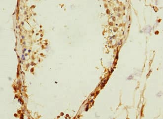 Polyclonal Rabbit anti-Human RANBP3 Antibody (IHC)