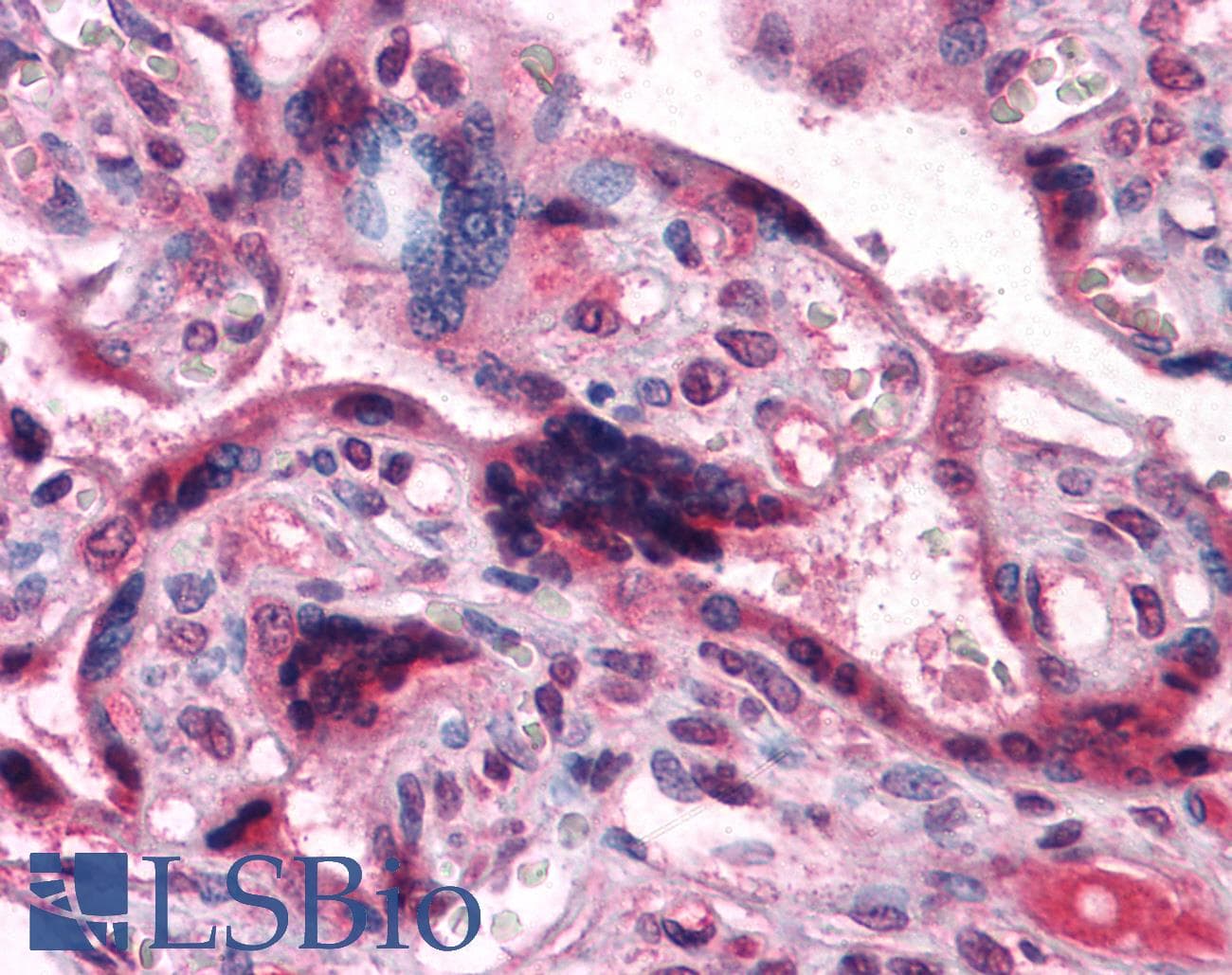 IHC-plus™ CTNNB1 / Beta Catenin Antibody (clone 4D5)