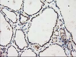 PRKCE / PKC-Epsilon Antibody (clone OTI2A12)