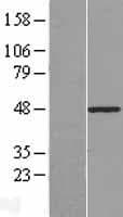PLAGL1 / ZAC Protein (Over-Expression Lysate Myc-DDK (Flag))