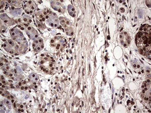 Monoclonal Mouse anti-Human SAE1 Antibody (clone OTI6B11, IHC, WB)
