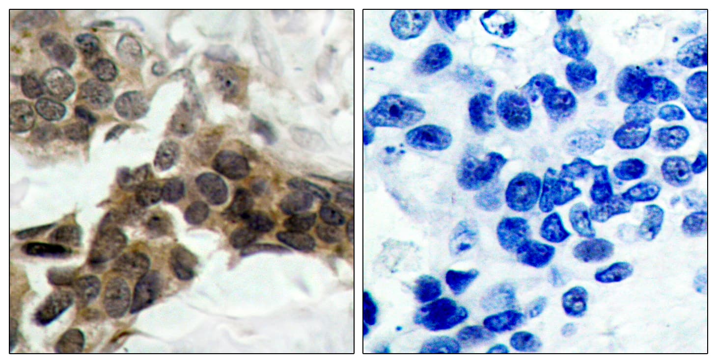 Polyclonal Rabbit anti-Human NFKBIA / IKB Alpha / IKBA Antibody (phospho-Ser32/Ser36, IHC, IF, WB)