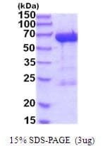 Human LTA4H / LTA4 Protein (Recombinant His)