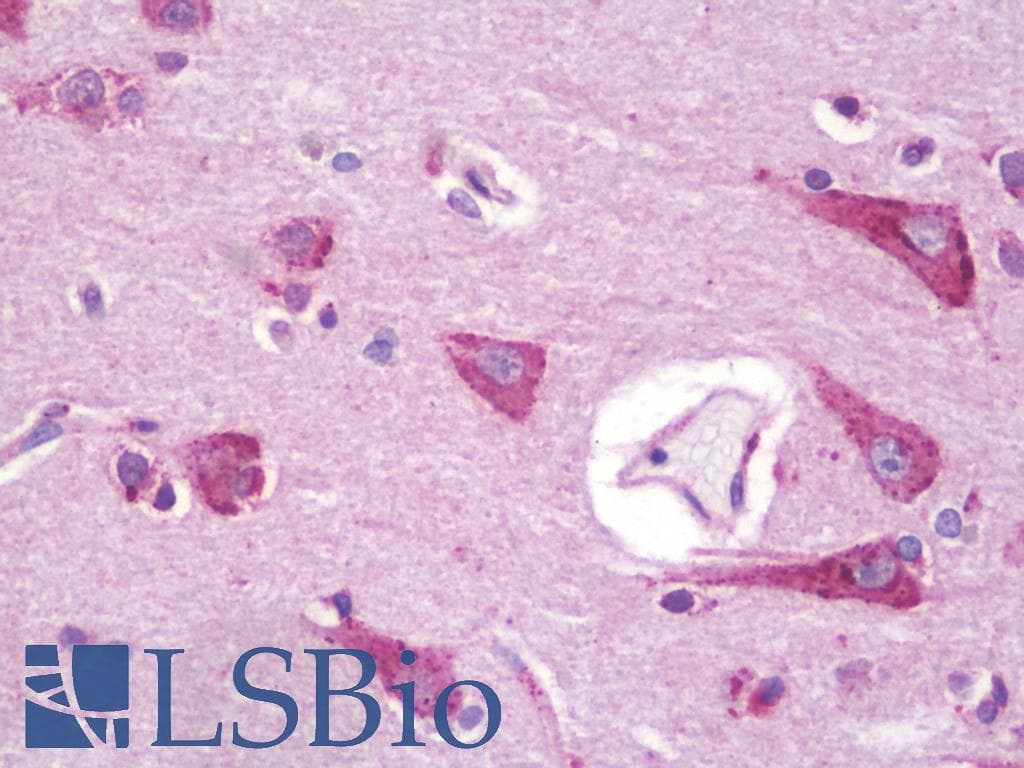 PathPlus™ Polyclonal Rabbit anti-Human APLNR/ Apelin Receptor / APJ Antibody (Extracellular Domain, IHC)
