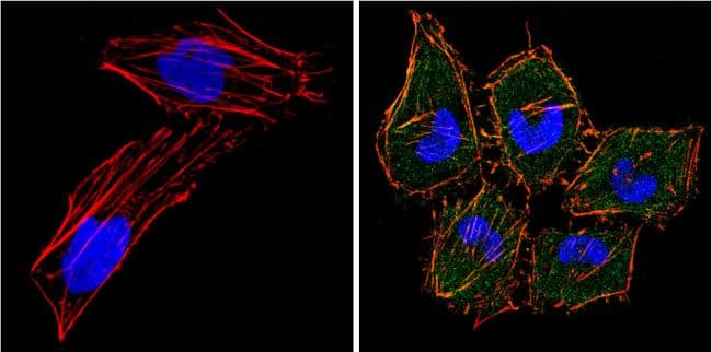 Monoclonal Mouse anti-Human EIF4E Antibody (clone 5D11, IF, WB)