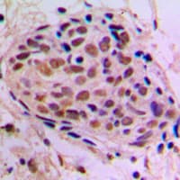 CREB1 / CREB Antibody (Internal)