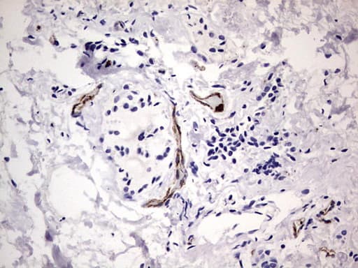 VWF / Von Willebrand Factor Antibody (aa764-1263, clone OTI7G3, Carrier-free)