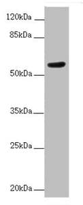 Polyclonal Rabbit anti-Human ACVRL1 Antibody (IF, WB)