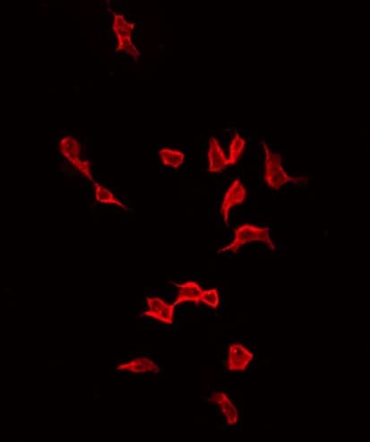 ACTA1 / Skeletal Muscle Actin Antibody