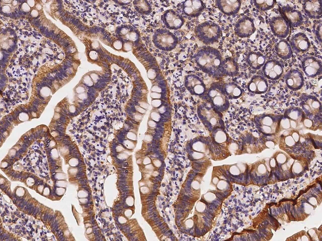 Polyclonal Rabbit anti-Human AHCYL1 / DCAL Antibody (IHC, IF, WB)