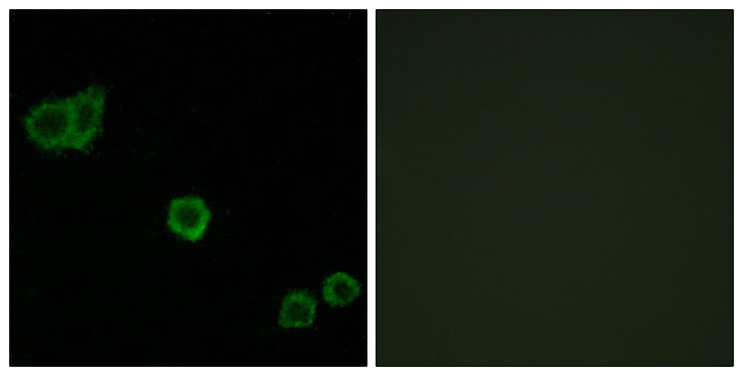 Polyclonal Rabbit anti-Human PPP1R14A / CPI-17 Antibody (aa5-54, IHC, IF, WB)