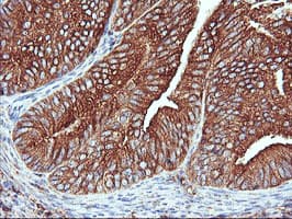ENPEP / Aminopeptidase A Antibody (clone OTI3G1)